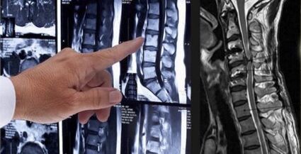 Diagnoza bólu pleców